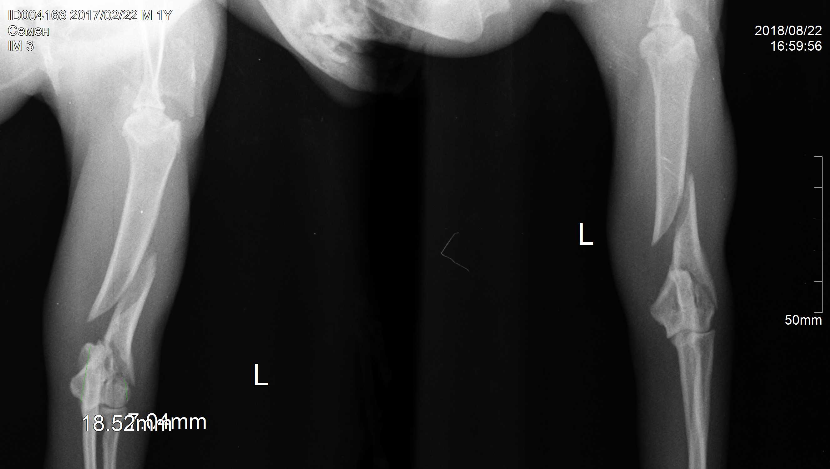 рентген-снимок перелома плечевой кости у кота